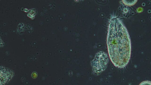 Protozoa under microscope magnification, move their rivulets to move and swallow food.