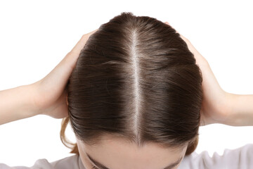 Naklejka premium Girl with hair loss problem on white background, closeup