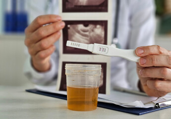 Evaluation of urine test results positive pregnancy test and ultrasound concept