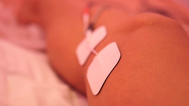 Athlete Undergoing Electrical Stimulation Therapy for Knee Injury at a Physical Therapy Clinic
