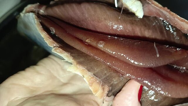 Worms in salted herring. Fish with worms. Nematode parasites in fish. Parasitosis. Anisakid larvae. Food poisoning. Infection with parasites. A woman cleans a fish with worms.