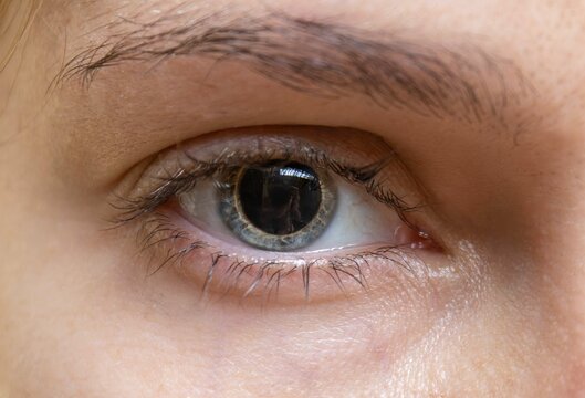 Dilated pupil of a woman's eye