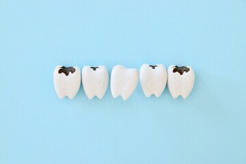 虫歯だらけの中で残っている一本の健康な歯