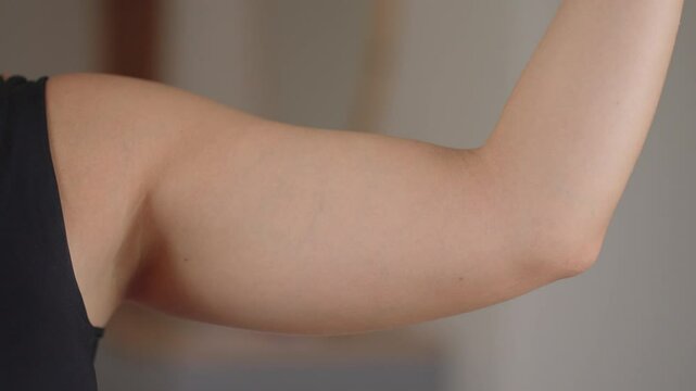 Close up shot of of a woman pinching the skin beneath her arm. Showing her fatty arm which needs to get reduced. No face
