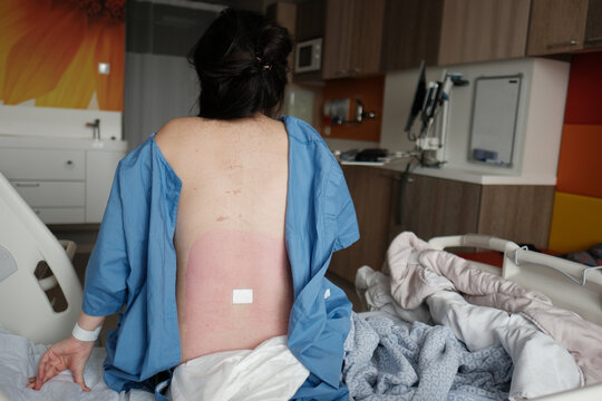 Woman with post epidural injection bandaid on a hospital bed.