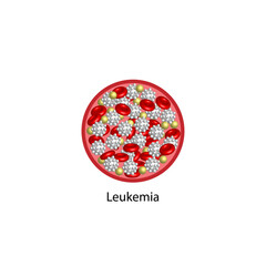Leukemia, blood cancer. Erythrocytes, platelets and leukocytes. Vector illustration.