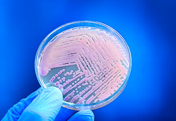 scientist hand holding petri dish with colony of Escherichia coli (E. coli) 