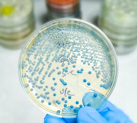 scientist hand holding petri dish with colony of Klebsiella spp.