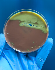 Streptococcus pneumoniae colony in blood agar media on petri dish in doctor hand.