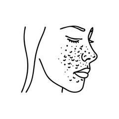 Acne on skin face Line art flat vector illustration on white background