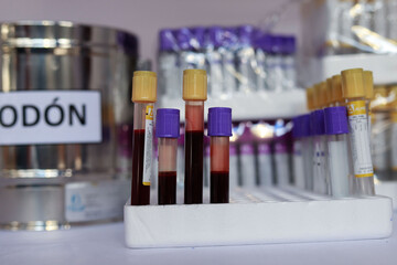 Tubos extracción de sangre