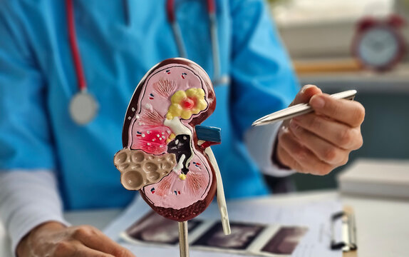 Doctor urologist holds model of kidney