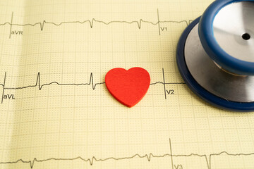 Stethoscope on electrocardiogram ECG, heart wave, heart attack, cardiogram report.
