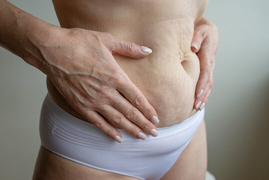 Mature woman applying body cream on abdomen with cilulite