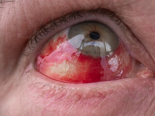 Close-up view of bloodshot male eye

