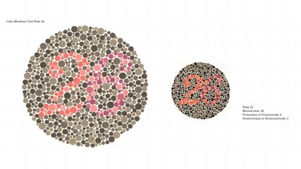 Eye Color vision test, Color Blindness Test Plate 16, Ishihara, Plate 22, Normal view: 26,...
