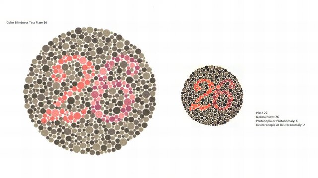 Eye Color vision test, Color Blindness Test Plate 16, Ishihara, Plate 22, Normal view: 26, Protanopia or Protanomaly: 6, Deuteranopia or Deuteranomaly: 2.