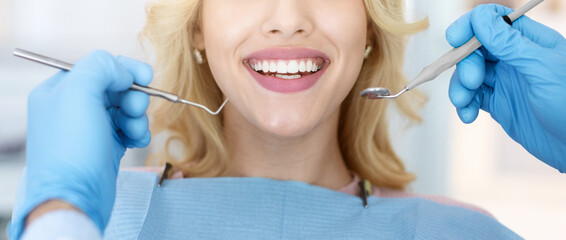 Cropped of female patient showing her white teeth while having checkup at dental clinic, dentist...