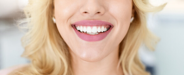 Unrecognizable blonde lady showing beautiful white teeth after treatment, sitting at dental chair,...