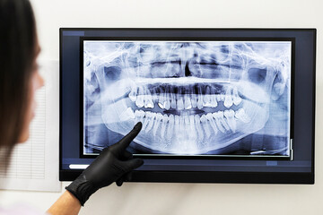 Dentist analyzes dental X-ray image