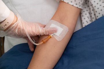 Doctor placing iv cannula in patient's arm for intravenous therapy