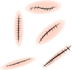 傷の縫合・傷跡・縫い傷・ダメージエフェクトイラスト素材セット