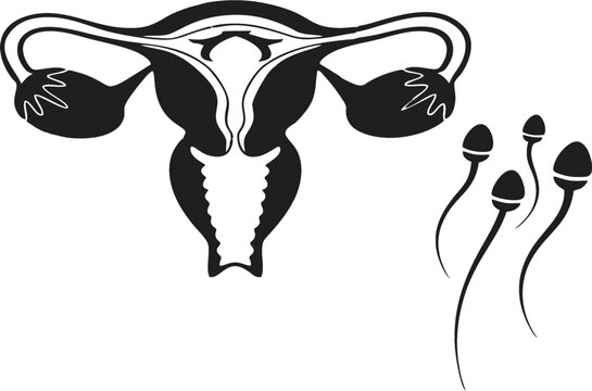 Woman uterus organ with sperms on white background. Gynecology or fertility clinic signboard, clinic and treatment offer poster or banner idea. Medical education vector, EPS 10.