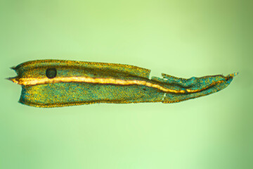 Micrograph of a moss leaf, Aulacomnium palustre, with polarization.