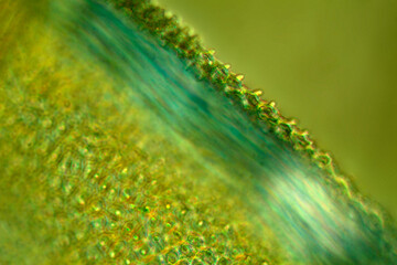 Micrograph of a papillose moss leaf, with polarization at 200x.