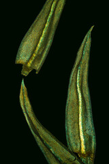 Abstract micrograph of moss leaves, Aulacomnium palustre, with polarization.