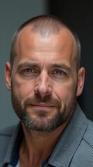 Obraz premium Hair Loss, Portrait And Man With Before And After For Results Of Stress, Cancer Or Depression In Men. Bald, Cosmetics And Skin By Scalp With Alopecia For Hairline Transplant