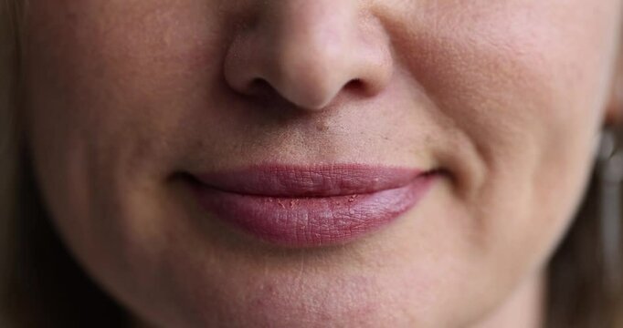 Woman lips showing natural texture and color variations and uneven crooked teeth in a smile