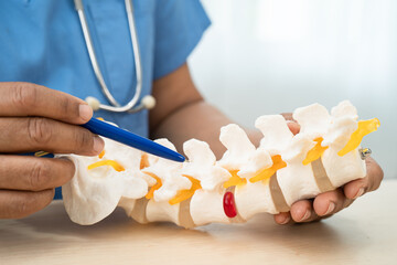 Doctor with lumbar vertebra bone skeleton and nerve model for treatment in the orthopedic...
