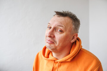 Obraz premium distorted face of sad and grieved very upset person, dissatisfied with his hard fate