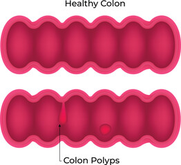 Healthy Colon Science Design Vector Illustration Diagram