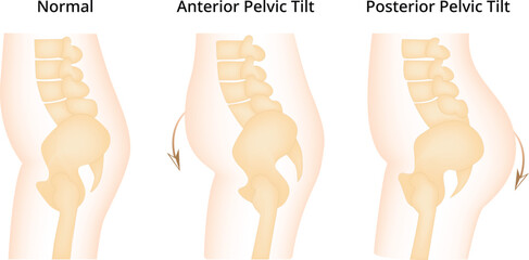 Normal Anterior Pelvic Tilt Posterior Tilt Science Design Vector Illustration Diagram