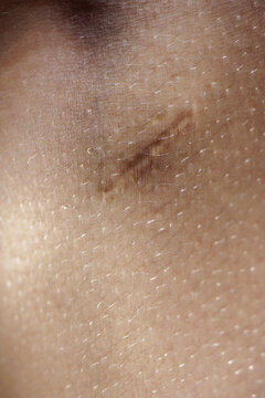 Close-Up of Skin with Scar, Natural Imperfections and Body Hair