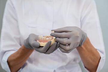 Dentist doctor holds a mannequin jaw model with teeth and implants in his hands in rubber gloves...