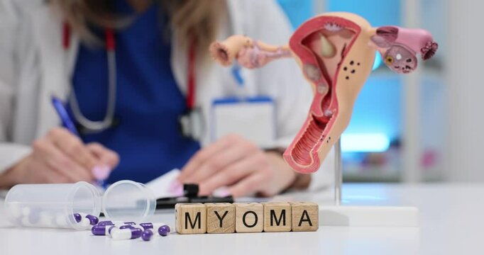 Myoma word and anatomical uterus model on gynecologist table. Doctor writes medical prescription explaining treatment plan to patient