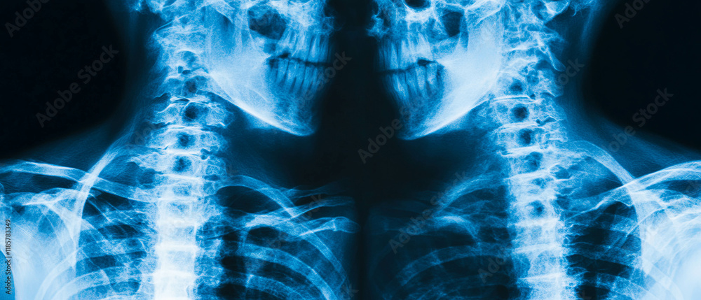 Poster Dynamic chaos in x-ray texture showcasing random noise and unpredictable effects