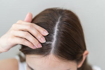 Damaged hair symptom, problem hair fall asian young woman, girl worry about balding, looking at scalp in mirror, hand in break into front hair loss, thin problem. Health care treatment for beauty.