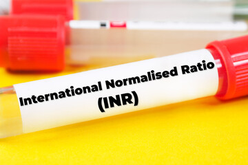 International Normalised Ratio (INR) text meaning analysis