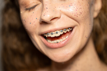 Fototapeta premium Funny young woman covered with glitter, licks metal braces, beauty portrait close-up
