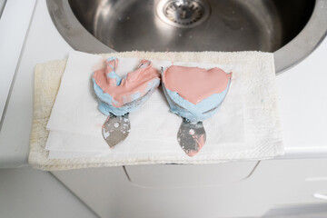 Dental impression trays resting on paper towels near sink in dental office