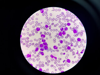 With blood cell in blood smear.