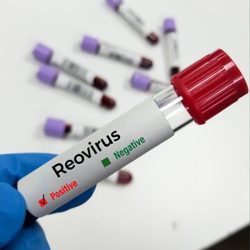 Blood test sample for Reovirus Test, Sedoreoviridae. RNA virus, 