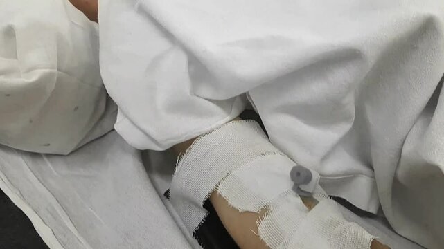 A preschool-age child lies in a hospital bed and receives medications through an intravenous drip