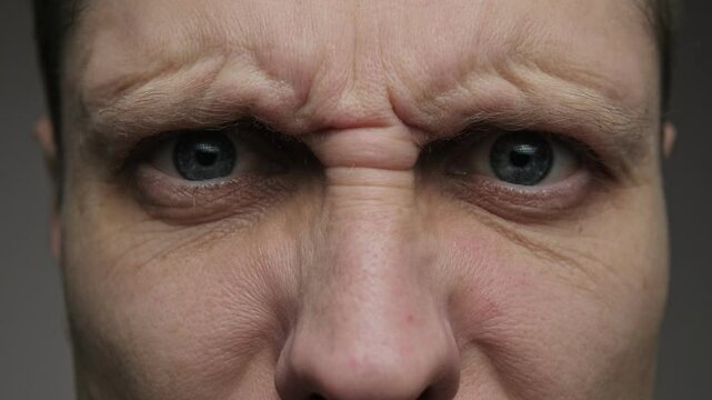 The video shows wrinkles forming on the forehead and between the eyebrows as a person frowns or concentrates. A demonstration of expression lines related to thinking or concern.