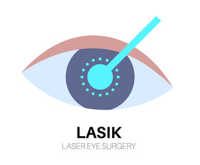 Lasik laser surgery