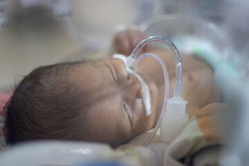 Closeup lovely little newborn baby infant lying in incubators for newborns, Newborn baby having the...
